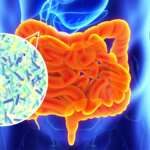 How to improve gut health naturally