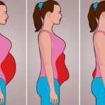 What causes belly fat in females