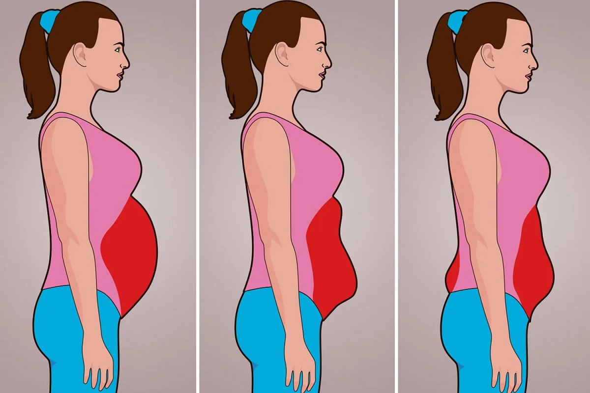 What causes belly fat in females